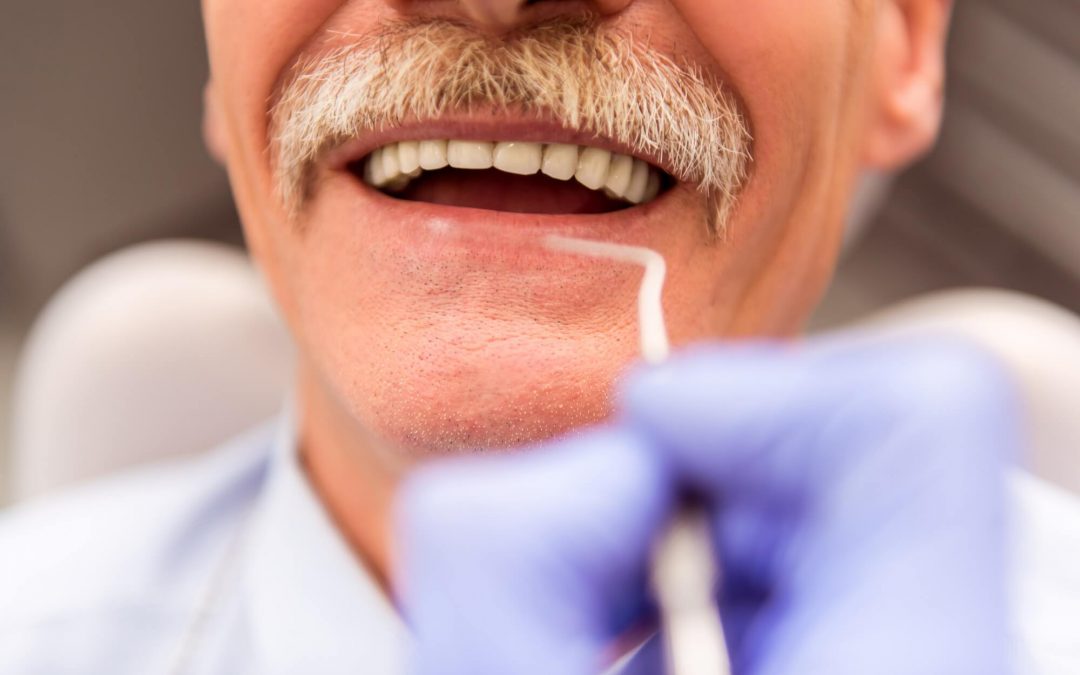 Implantes dentales: la solución para recuperar tu sonrisa