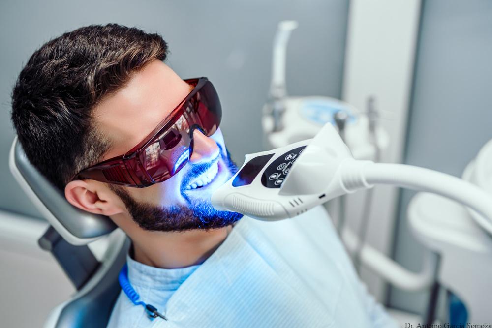 Descubre cómo funciona el blanqueamiento dental y qué resultados puedes esperar