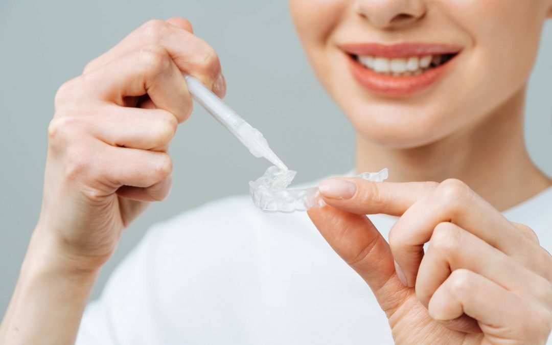 Cómo blanquear tus dientes en casa y consejos para mantenerlos después