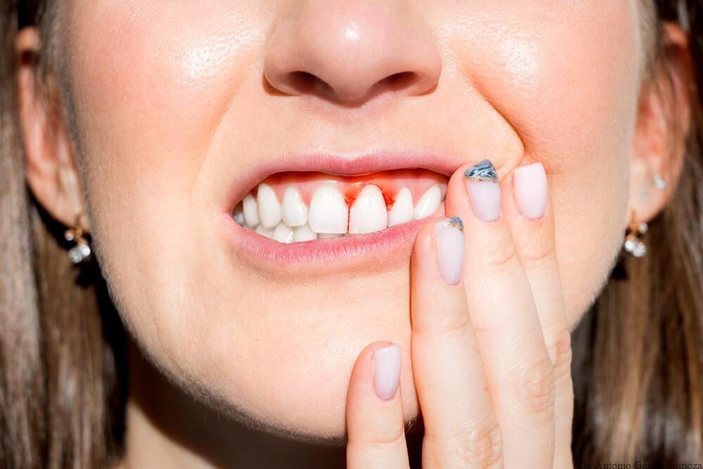 Cómo prevenir y tratar las enfermedades de las encías: la importancia de la salud periodontal