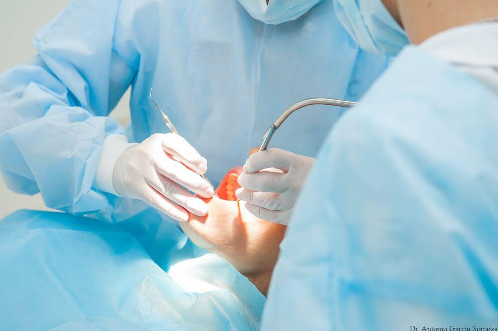 La importancia de los cuidados pre y postoperatorios en cirugías dentales: recomendaciones clave