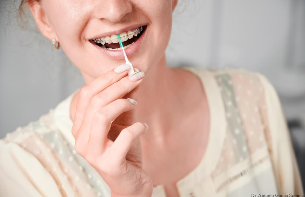 Higiene bucal para personas con brackets: consejos y trucos para un cuidado eficaz